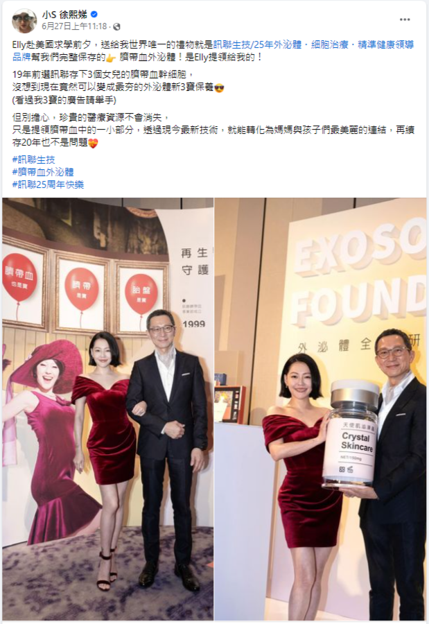 訊聯創新技術-臍帶血外泌體 Cord Blood Exosome，小S站台分享，是Elly送給她的獨一無二的禮物