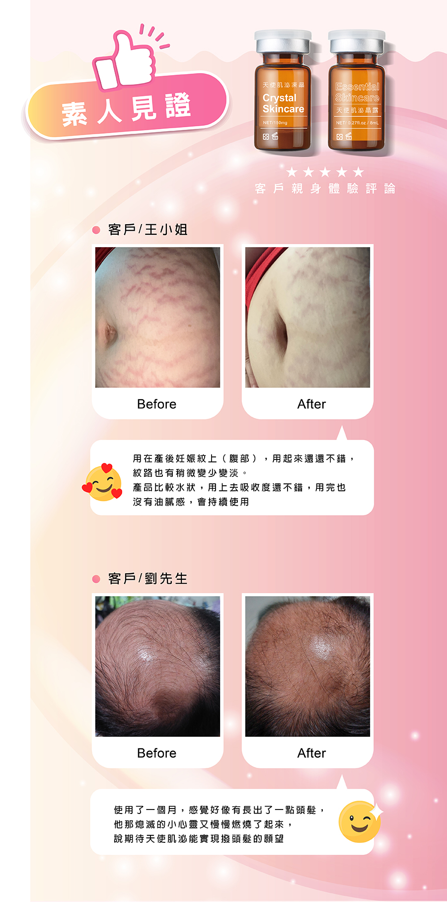 訊聯創新技術-臍帶血外泌體 Cord Blood Exosome，具有彈潤抗老、撫平紋路、平滑細緻、賦活修護等功能，是寶寶送給家人的第一份禮物